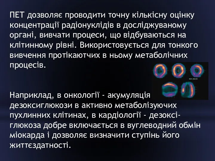 ПЕТ дозволяє проводити точну кількісну оцінку концентрації радіонуклідів в досліджуваному