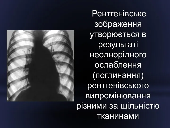 Рентгенівське зображення утворюється в результаті неоднорідного ослаблення (поглинання) рентгенівського випромінювання різними за щільністю тканинами