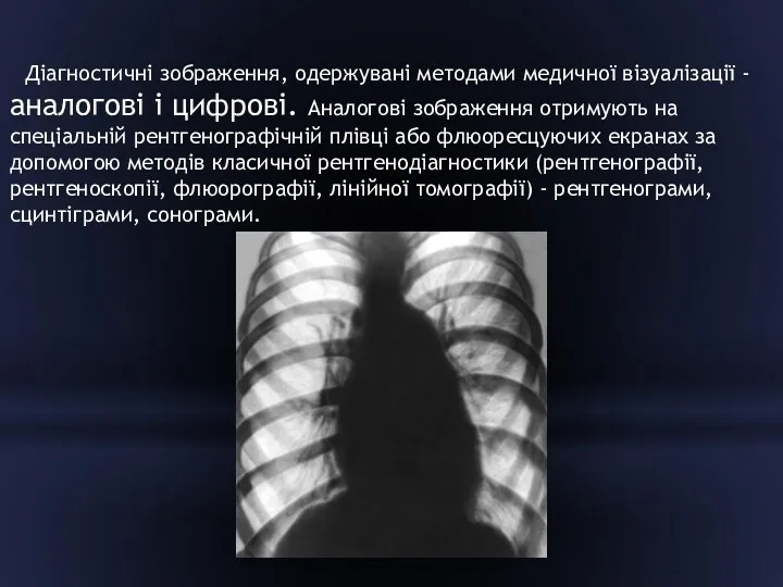 Діагностичні зображення, одержувані методами медичної візуалізації - аналогові і цифрові.