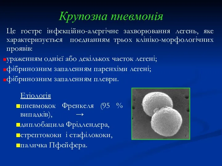 Крупозна пневмонія Це гостре інфекційно-алергічне захворювання легень, яке характеризується поєднанням