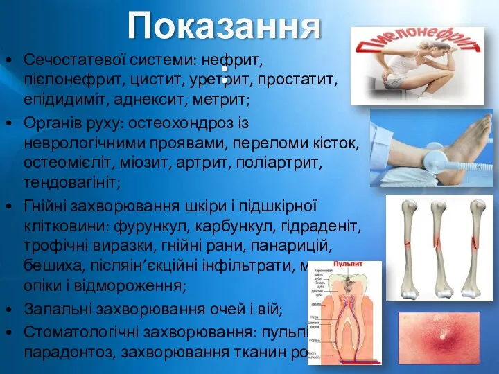 Сечостатевої системи: нефрит, пієлонефрит, цистит, уретрит, простатит, епідидиміт, аднексит, метрит;