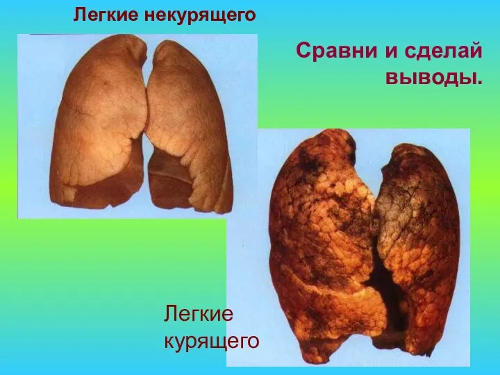 Сравни и сделай выводы. Легкие некурящего Легкие курящего