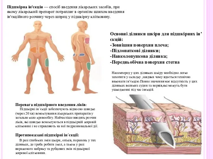 Підшкірна ін'єкція — спосіб введення лікарських засобів, при якому лікарський