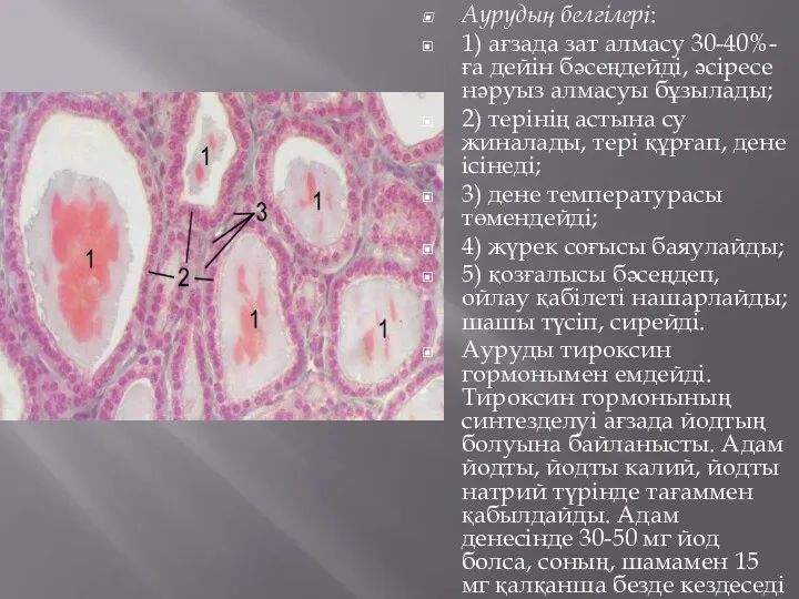 Аурудың белгілері: 1) ағзада зат алмасу 30-40%-ға дейін бәсеңдейді, әсіресе нәруыз алмасуы бұзылады;