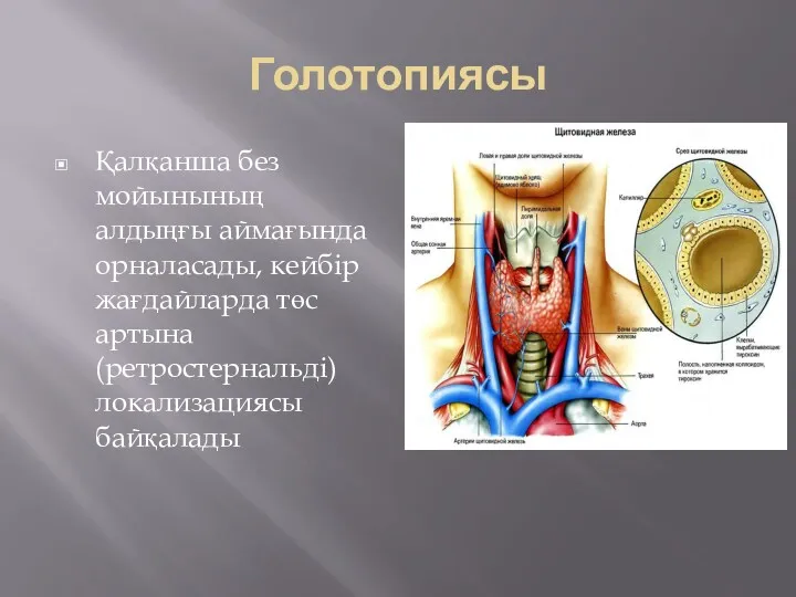 Голотопиясы Қалқанша без мойынының алдыңғы аймағында орналасады, кейбір жағдайларда төс артына (ретростернальді) локализациясы байқалады