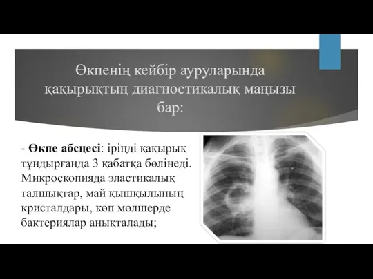 Өкпенің кейбір ауруларында қақырықтың диагностикалық маңызы бар: - Өкпе абсцесі: