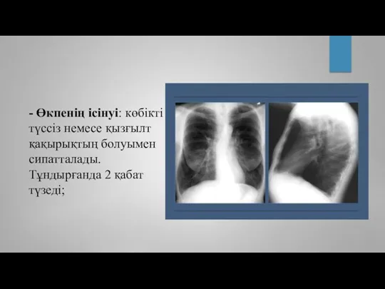 - Өкпенің ісінуі: көбікті түссіз немесе қызғылт қақырықтың болуымен сипатталады. Тұндырғанда 2 қабат түзеді;