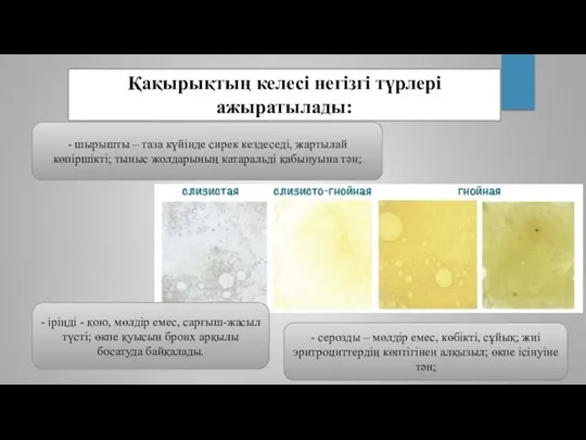 Қақырықтың келесі негізгі түрлері ажыратылады: - шырышты – таза күйінде