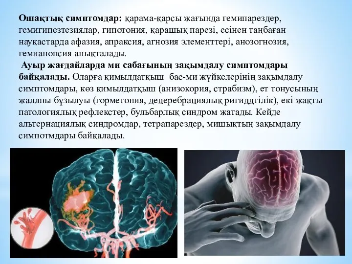 Ошақтық симптомдар: қарама-қарсы жағында гемипарездер, гемигипезтезиялар, гипотония, қарашық парезі, есінен