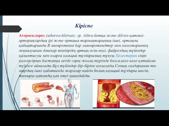 Атеросклероз (atheroschlerosis: гр. Athra-ботқа және sklrsis-қатаю)-артериялардың ірі және орташа тармақтарының