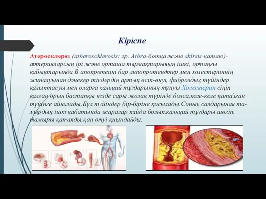 Атеросклероз (atheroschlerosis: гр. Athra-ботқа және sklrsis-қатаю)-артериялардың ірі және орташа тармақтарының ішкі, ортаңғы қабықтарында