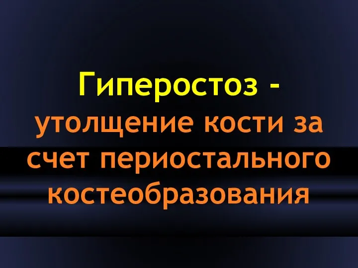 Гиперостоз - утолщение кости за счет периостального костеобразования