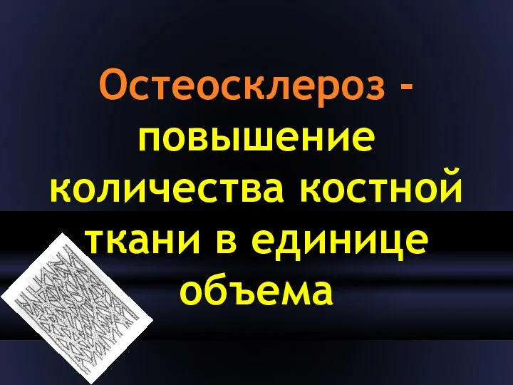 Остеосклероз - повышение количества костной ткани в единице объема