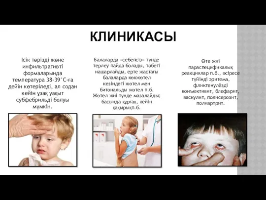 КЛИНИКАСЫ Ісік тәрізді және инфильтративті формаларында температура 38-39°С-ға дейін көтеріледі,