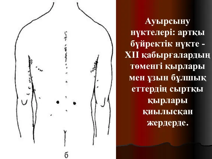 Ауырсыну нүктелері: артқы бүйректік нүкте - ХІІ қабырғалардың төменгі қырлары