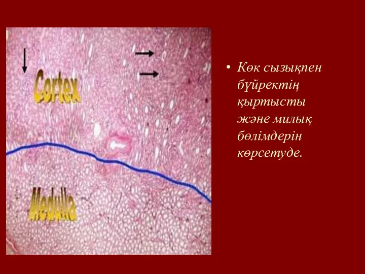 Көк сызықпен бүйректің қыртысты және милық бөлімдерін көрсетуде.