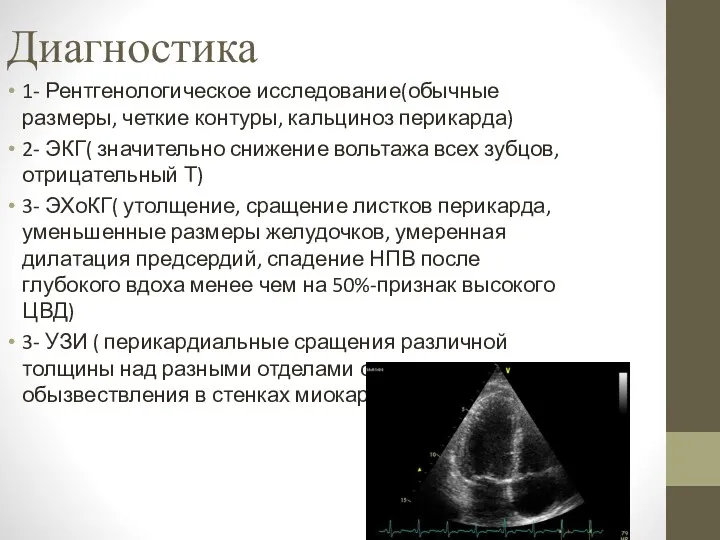 Диагностика 1- Рентгенологическое исследование(обычные размеры, четкие контуры, кальциноз перикарда) 2-