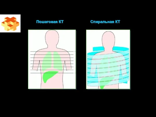 Пошаговая КТ Спиральная КТ
