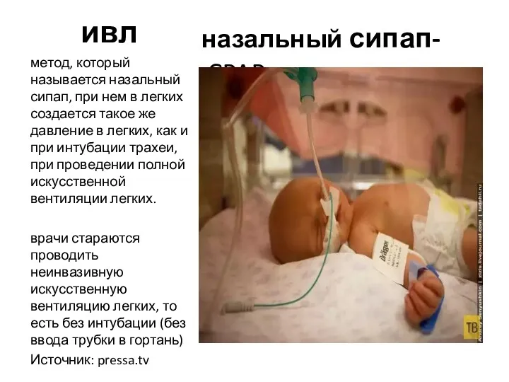 ивл назальный сипап- CPAP метод, который называется назальный сипап, при нем в легких