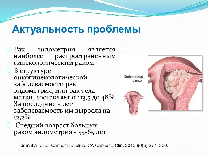 Актуальность проблемы Рак эндометрия является наиболее распространенным гинекологическим раком В