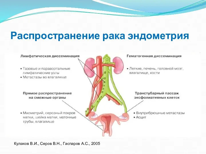 Распространение рака эндометрия Кулаков В.И., Серов В.Н., Гаспаров А.С., 2005