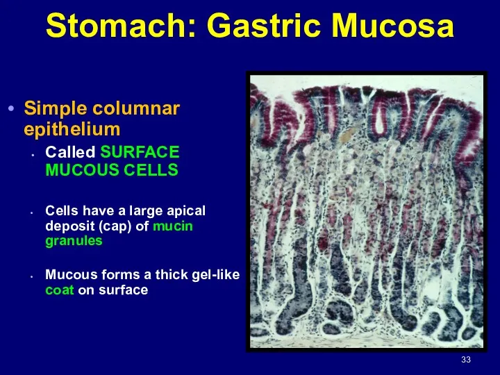 Stomach: Gastric Mucosa Simple columnar epithelium Called SURFACE MUCOUS CELLS