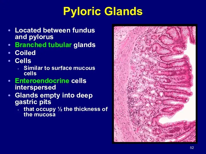 Pyloric Glands Located between fundus and pylorus Branched tubular glands