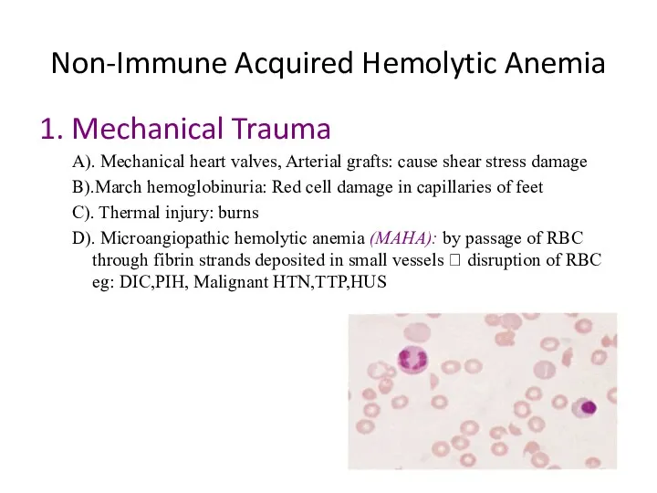 Non-Immune Acquired Hemolytic Anemia 1. Mechanical Trauma A). Mechanical heart