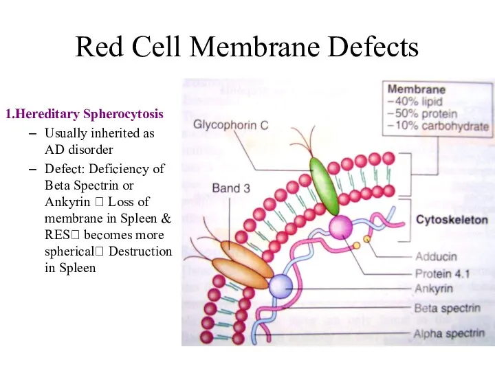 Red Cell Membrane Defects 1.Hereditary Spherocytosis Usually inherited as AD
