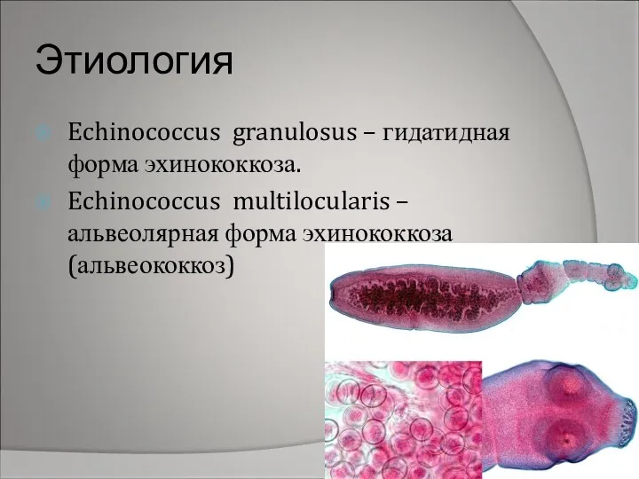 Этиология Echinococcus granulosus – гидатидная форма эхинококкоза. Echinococcus multilocularis – альвеолярная форма эхинококкоза (альвеококкоз)