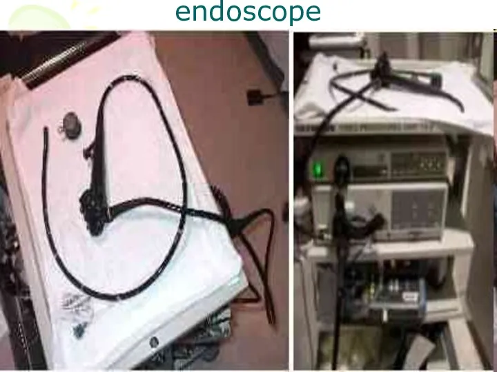 endoscope