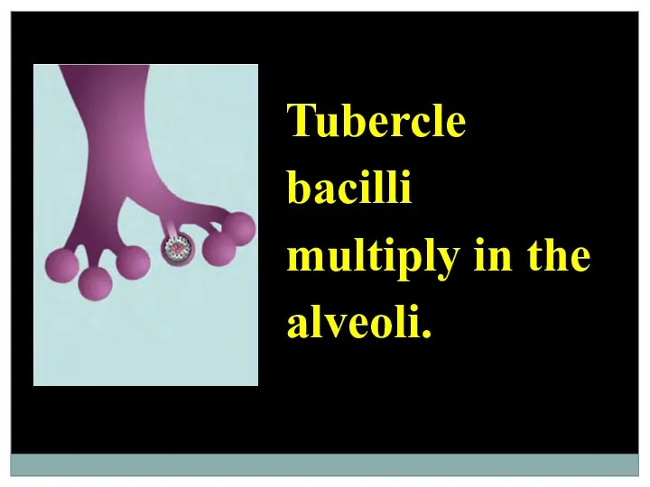 Tubercle bacilli multiply in the alveoli.