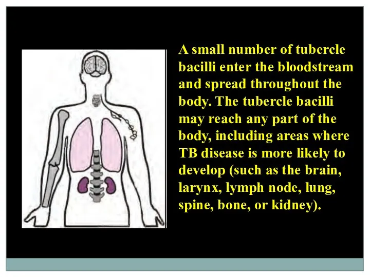 A small number of tubercle bacilli enter the bloodstream and