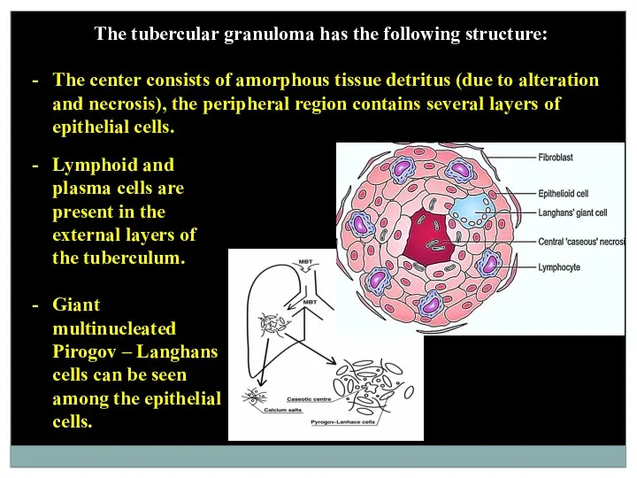 The tubercular granuloma has the following structure: The center consists
