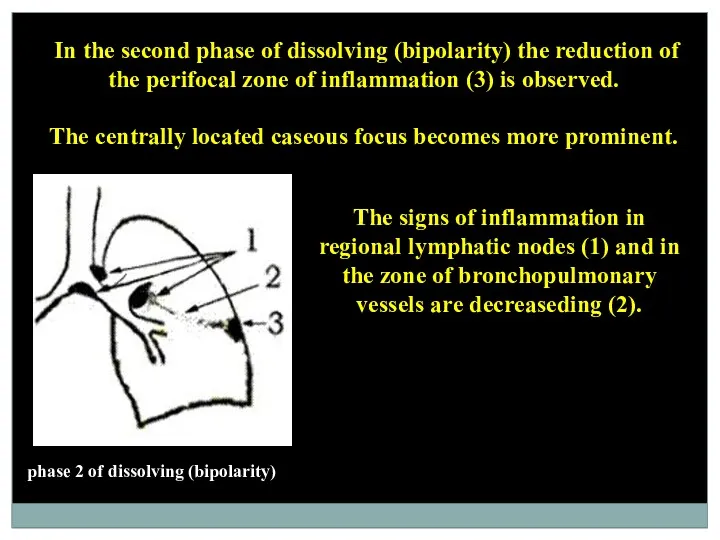 phase 2 of dissolving (bipolarity) In the second phase of