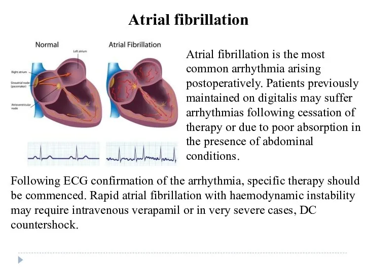 Following ECG confirmation of the arrhythmia, specific therapy should be