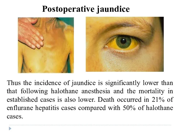 Thus the incidence of jaundice is significantly lower than that