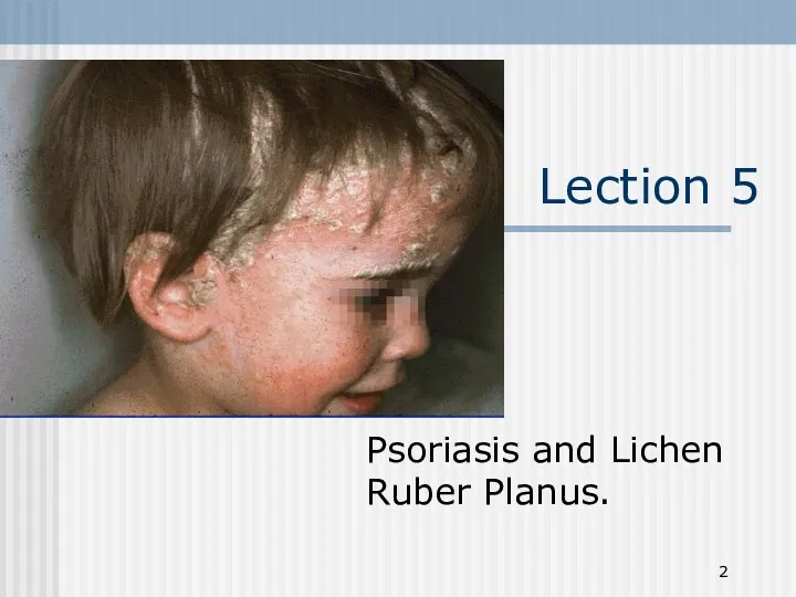 Lection 5 Psoriasis and Lichen Ruber Planus.