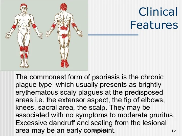 Lection4 Clinical Features The commonest form of psoriasis is the