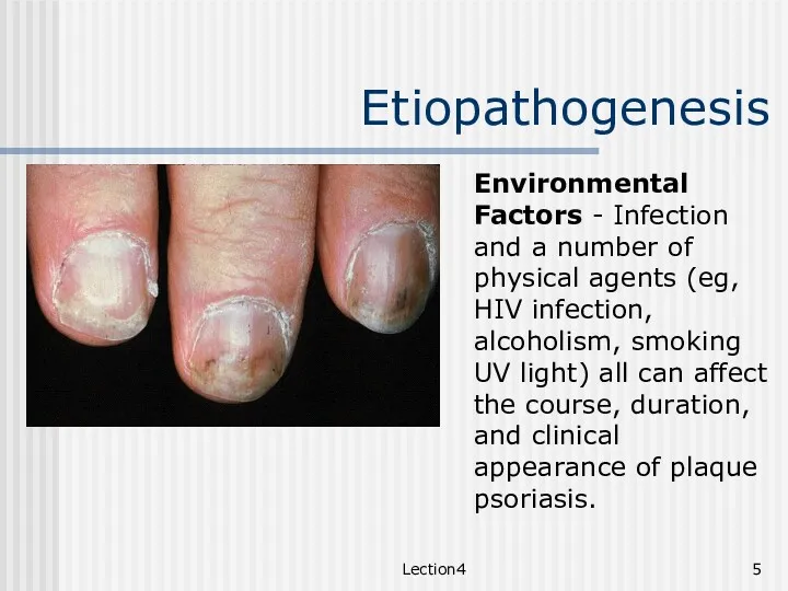 Lection4 Etiopathogenesis Environmental Factors - Infection and a number of