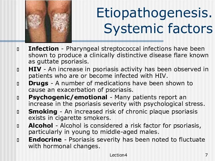 Lection4 Etiopathogenesis. Systemic factors Infection - Pharyngeal streptococcal infections have