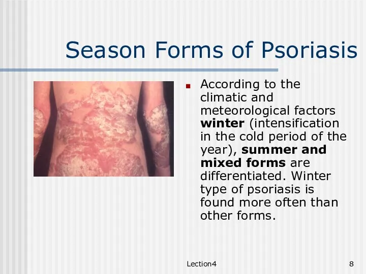 Lection4 Season Forms of Psoriasis According to the climatic and