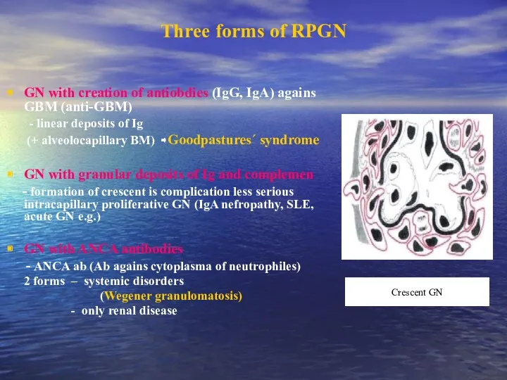 Three forms of RPGN GN with creation of antiobdies (IgG,