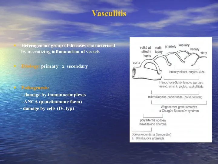 Vasculitis Heterogenous group of diseases characterised by necrotizing inflammation of