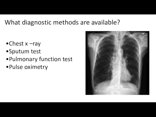 What diagnostic methods are available? •Chest x –ray •Sputum test •Pulmonary function test •Pulse oximetry