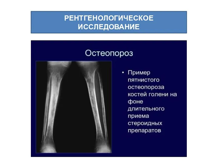 РЕНТГЕНОЛОГИЧЕСКОЕ ИССЛЕДОВАНИЕ