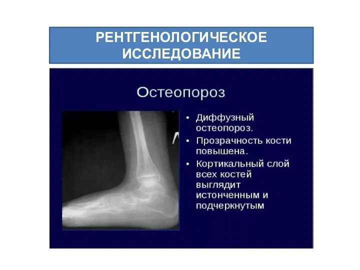 РЕНТГЕНОЛОГИЧЕСКОЕ ИССЛЕДОВАНИЕ