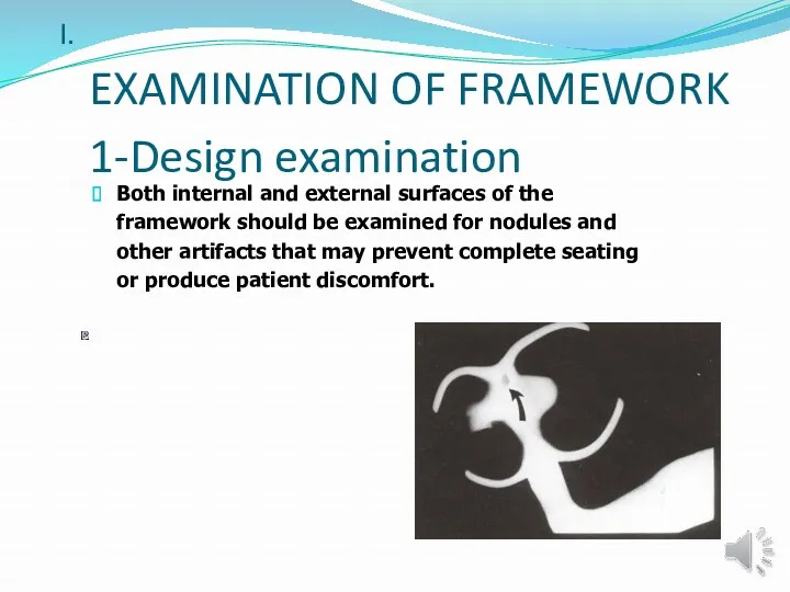 EXAMINATION OF FRAMEWORK 1-Design examination Both internal and external surfaces