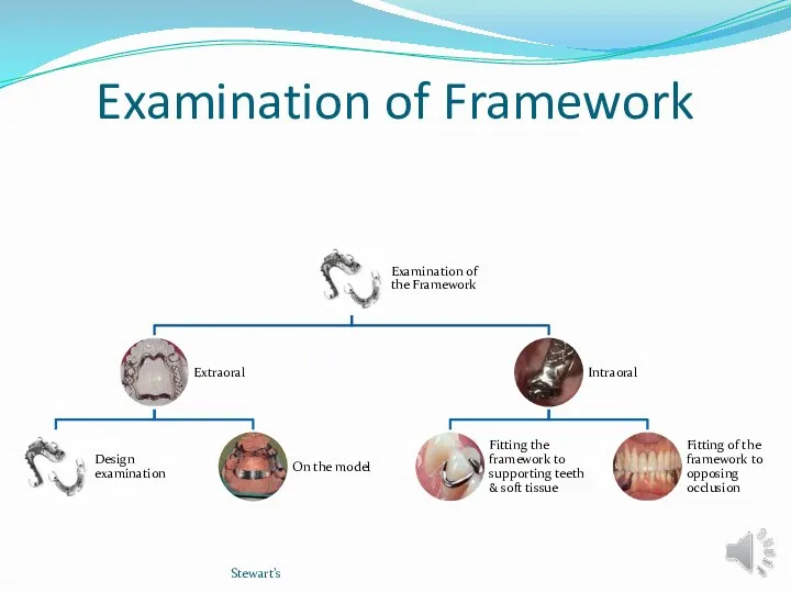 Examination of Framework Stewart’s