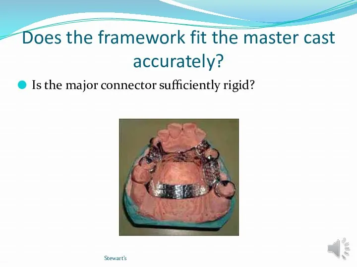 Does the framework fit the master cast accurately? Is the major connector sufficiently rigid? Stewart’s